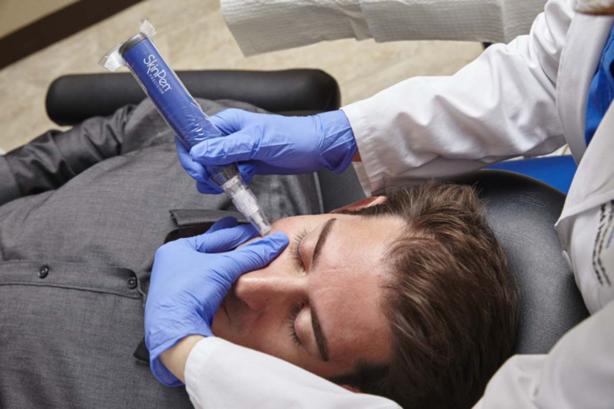 SkinPen Microneedling